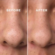 BHA Blackhead Power Liquid - Imagen 4