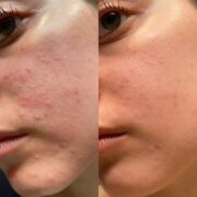 Centella Blemish Cream - Imagen 5