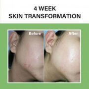 The Real Noni Energy Ampoule - Imagen 3