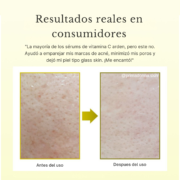 Vitamin C Booster Shot- Vit C pura + Glutatión - Imagen 4