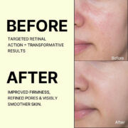 The Vita-A Retinal Shot Tightening Booster - Imagen 5