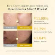 KOJIC ACID TURMERIC NIACINAMIDE SERUM - Imagen 4