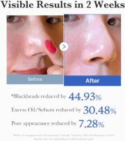 medicube Zero Pore Pad 2.0 - Imagen 4